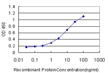 E - GSDML Antibody (monoclonal) (M06) AT2271a